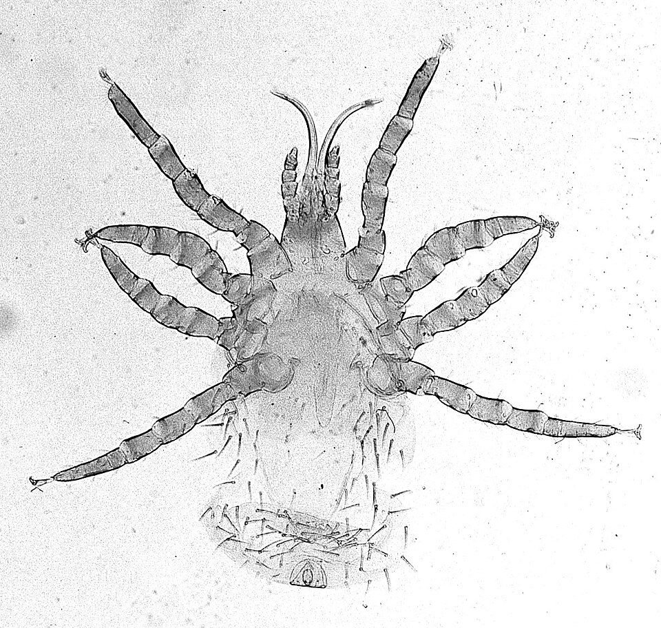 Ornithonyssus mite, a bird parasite, seen under a microscope with long spiny legs